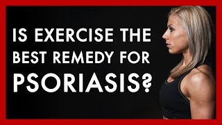 Is exercise the best remedy for psoriasis [upl. by Gnuoy286]