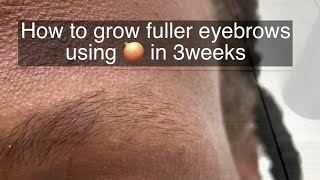 How To Grow Thicker Eyebrows Naturally and Faster [upl. by Lorre]