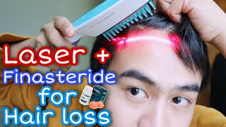 Hairmax laser comb  Finasteride 2 years update for HAIR LOSS [upl. by Darbie487]