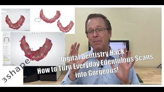 Digital Dentistry Secret Hack  How to Turn Everyday Edentulous Scans into Gorgeous [upl. by Alih]