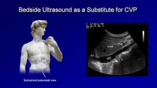 Shock Lesson 2  Distinguishing Shock Types HypovolemicDistributiveCardiogenicObstructive [upl. by Lawrenson]