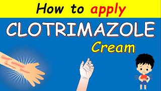 Clotrimazole cream Lotrimin How to apply  Uses and Side effects [upl. by Anrehs]