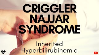 Criggler Najjar SyndromeInherited HyperbilirubinemiaThe Beat yt [upl. by Sieber]