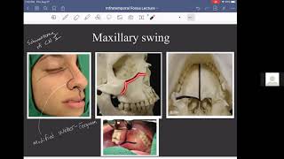 Anatomy of the Infratemporal Fossa [upl. by Procter]