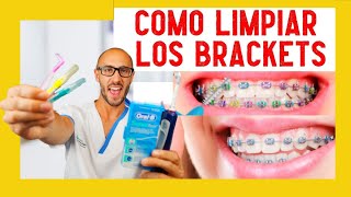 ⚠️ Como LIMPIAR los BRACKETS en 5 minutos ✅ [upl. by Mcconnell]