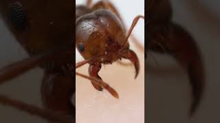 Fire ant bite and sting upclose [upl. by Reitman]