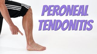 Peroneal Tendonitis Side of Foot Pain Causes amp SelfTreatment [upl. by Primavera]