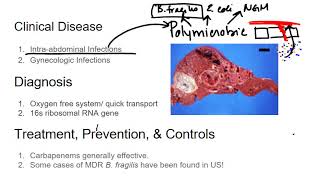 Gram Negative Rods Bacteroidies fragilis [upl. by Dietsche769]