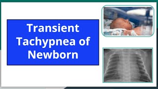 Transient tachypnea of newborn mbbs newbornneonatology neetpg pediatrics nursing ttn [upl. by Cassiani951]