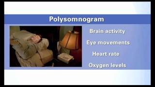 OSA Journey Chapter 1  What to expect during and after your sleep study [upl. by Dygal]