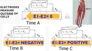 Electromyography EMG Biopac lecture [upl. by Pell]