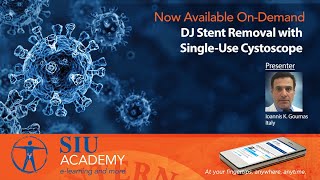 Clip DJ Stent Removal With Single Use Cystoscope [upl. by Algie]