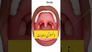 Bacho main tonsil ki wajoohat  heathbenefits tonsilstones tonsillitis tonsils shortsviral [upl. by Corella575]