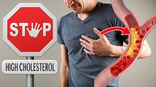 10 Best Foods to Lower Your Cholesterol [upl. by Aretak]