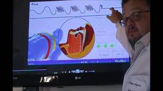 APNEIA OBSTRUTIVA COMO UMA PESSOA MORRE DORMINDO15991020012 whats [upl. by Nirro]