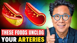 ANTIAGING Foods That UNCLOG Your ARTERIES💥 Dr William Li [upl. by Rafaelita967]