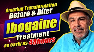 10 People Before and After Ibogaine Treatment [upl. by Ymaral862]