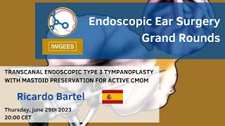 Transcanal endoscopic tympanoplasty with mastoid preservation for active CMOM  Ricardo Bartel [upl. by Naus]