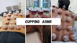 Cupping therapy Asmr amp body relaxation [upl. by Barrett]