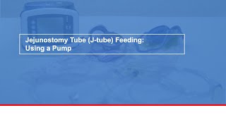 Jejunostomy tube Jtube feeding Using a pump [upl. by Atelokin]