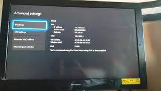 How to fix teredo ip issue on Xbox One and Series X 100 Still working in 2024 [upl. by Kcirdlek]