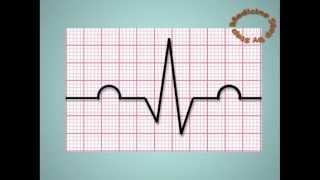 Understanding ECGs  EKG [upl. by Eniarrol]