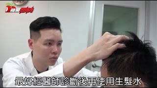 生髮水你擦對了嗎？讓謝宗廷醫師告訴你正確用法 [upl. by Porche]