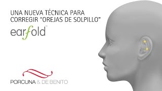 Nueva técnica para corregir las orejas de soplillo Earfold [upl. by Marylou614]