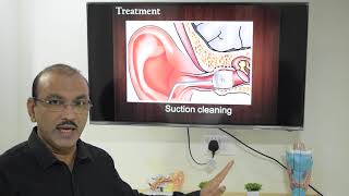 Fungal infection of ear Malayalam Patient teaching programme [upl. by Ettennal]