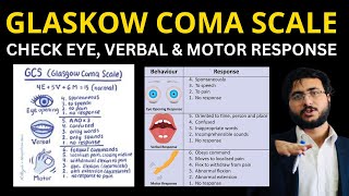 Mastering the Glasgow Coma Scale Complete Guide Scoring System and Clinical Applications [upl. by Belinda]