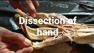 Dissection of hand Muscle of hand Anatomy of hand [upl. by Adialeda799]