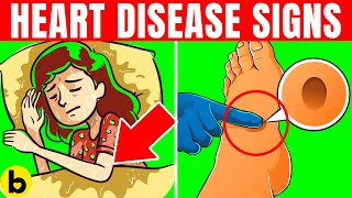 15 Early Warning Signs Of Heart Disease You Should Lookout For [upl. by Turley]