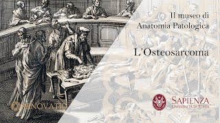 Il Museo di Anatomia Patologica  L Osteosarcoma [upl. by Adaj]