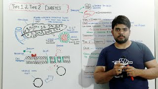 Diabetes mellitus diagnosis in hindi TreatmentComplicationsManagementMsn [upl. by Yneffit591]