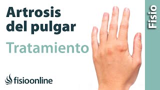 Qué es la rizartrosis o artrosis trapeciometacarpiana del pulgar Causas y tratamiento [upl. by Nevram]