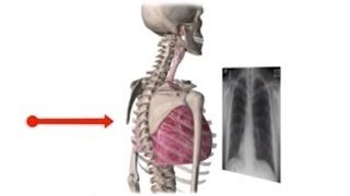 Chest XRay Basics in 5 min [upl. by Viehmann]