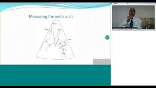 Diagnosis and Management of Coarctation of Aorta by Dr Suresh Kumar [upl. by Lepine]