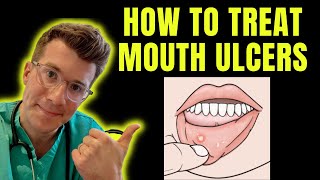 How to recognise and treat Mouth Ulcers getting rid of canker sores  Doctor ODonovan explains [upl. by Warenne]