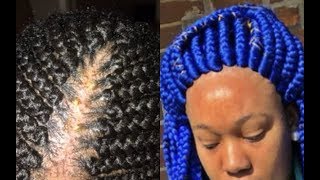 THEY BRAIDED HER SKIN HAIRSTYLES THAT MUST STOP IN 2019 [upl. by Eedoj]