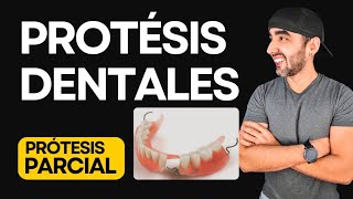 Que son las Prótesis Dentales Removibles Acrílicas [upl. by Llorrac]