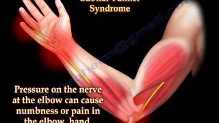 Cubital Tunnel Syndrome Ulnar Nerve Entrapment  Everything You Need To Know  Dr Nabil Ebraheim [upl. by Gregorius]