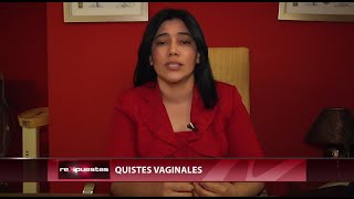 Quistes vaginales [upl. by Evelyn]