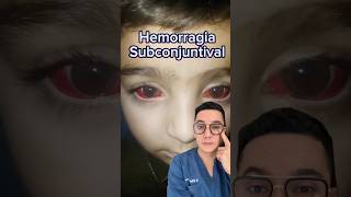 Sangre en el ojo hemorragia subconjuntival  Dr William Guerrero medicina shorts [upl. by Uzzi]