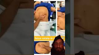 Fetas rotate in womb  baby fetus love newborn doctor song weekspregnant punjabisong music [upl. by Oicneserc]