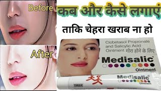 Kya Medisalic Cream गोरेपन की क्रीम Hai Medisalic Cream ke fayde  Honest Review [upl. by Notyard83]