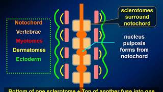 MedPix Video  Nonglial Tumors Chordoma Radiology [upl. by Tatianas192]