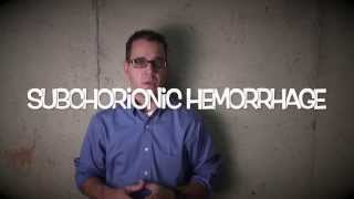 subchorionic hemorrhage  patient education video [upl. by Hausmann136]