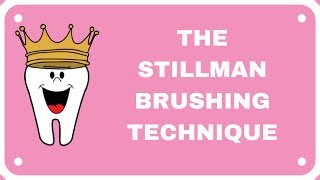 Stillman Brushing Technique [upl. by Nioe]