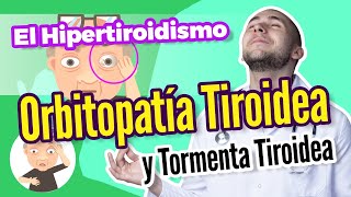 Hipertiroidismo orbitopatía tiroidea y crisis tirotóxica  Cap 73 74 y 75  Dr Mario Vega Carbó [upl. by Yatnwahs548]