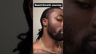 BEARD GROWTH 6 MONTH TRANSFORMSTION [upl. by Ajar]